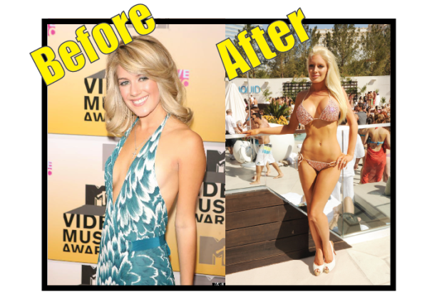 Heidi Montag before vs after
